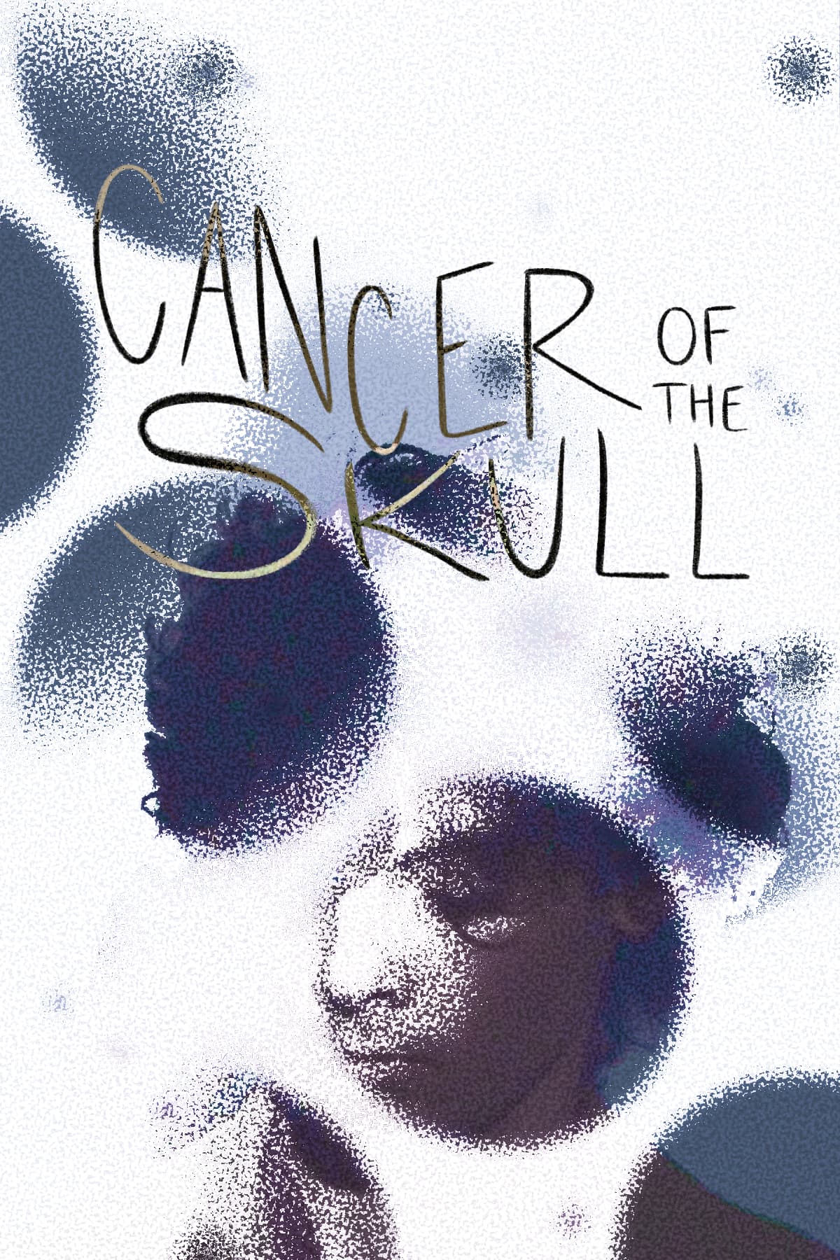 Cameron Winter's 'Cancer of the Skull' image